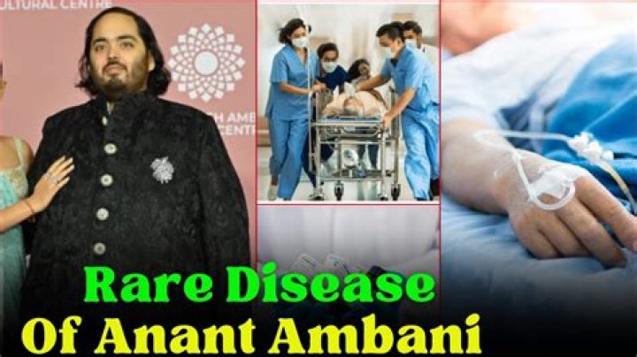 Unraveling The Mystery Of Anant Ambani's Rare Disease