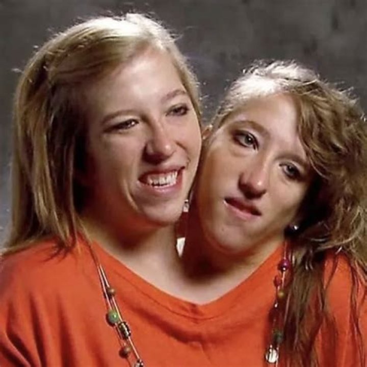 Unraveling The Mystery: Did Abby And Brittany Hensel Pass Away?