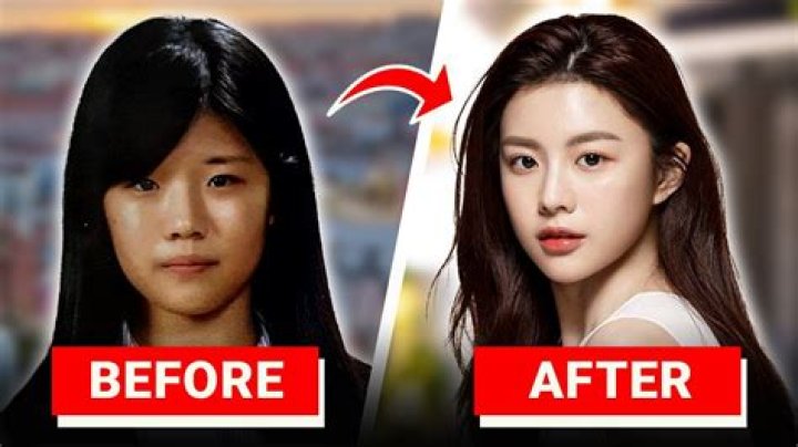 Unveiling The Truth: Do Korean Actors Get Plastic Surgery?