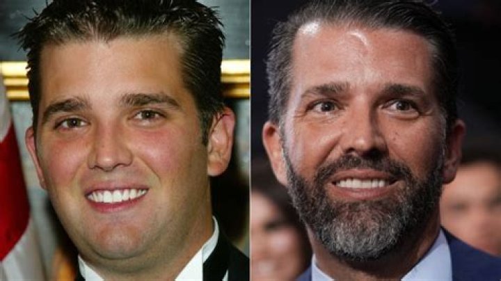 Unveiling The Truth: Donald Trump Jr. And His Plastic Surgery Journey