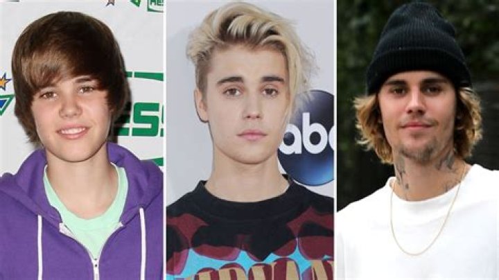 Justin Bieber: A Journey Through Transformation - Then Vs Now