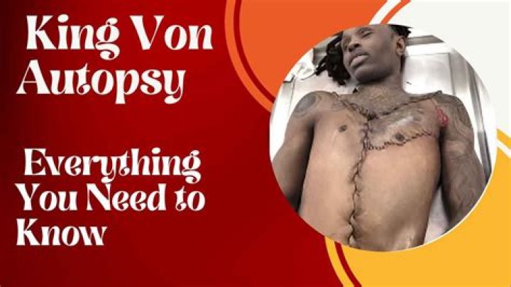 Unveiling The Truth: The Mystery Behind King Von Autopsy Photos