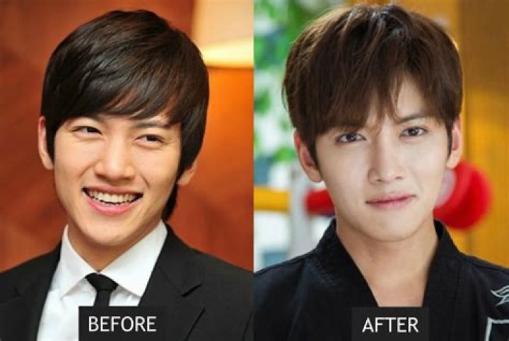 Korean Actors Who Embrace Plastic Surgery: A Closer Look
